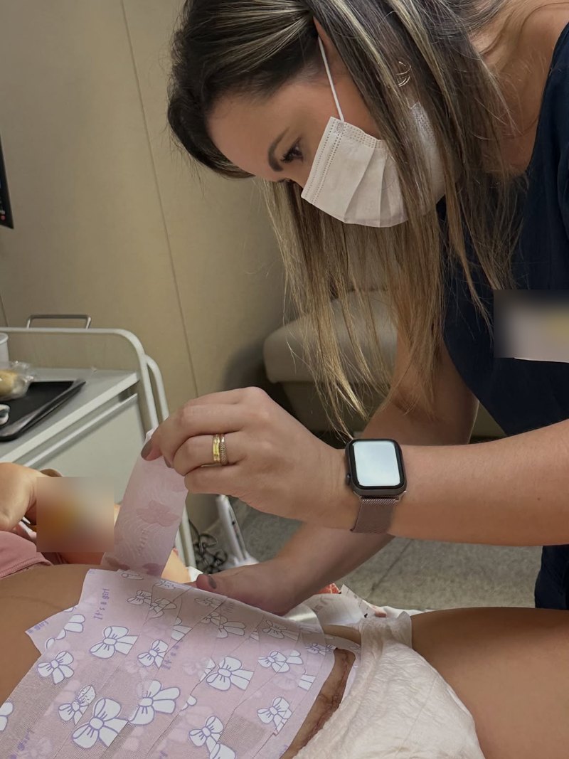 Aplicação de kinesiotape em paciente no pós-operatório